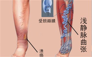 中新网:新奥资料免费精准-绞肠痧是什么病