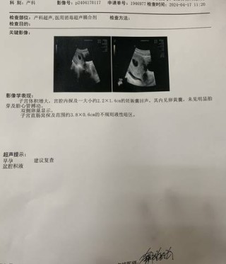 微博:2024新奥开奖结果-孕囊是什么