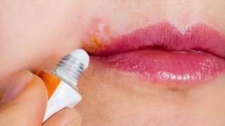 搜狐订阅：新澳门王中王资料公开-嘴唇起水泡是什么原因