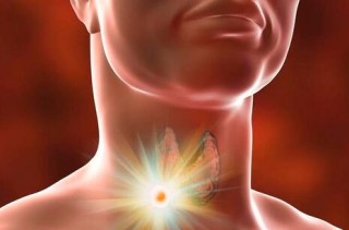 搜狗订阅:2024澳门正版资料免费大全-甲状腺结节有什么症状表现