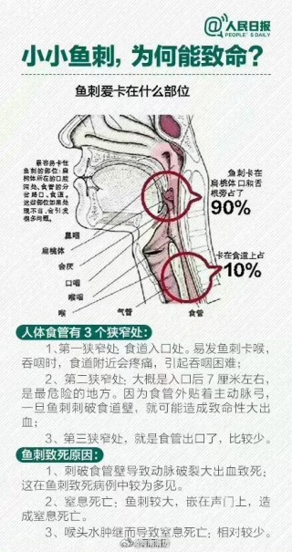 微博订阅:最准一肖一码一一子中特-鱼刺卡喉咙挂什么科