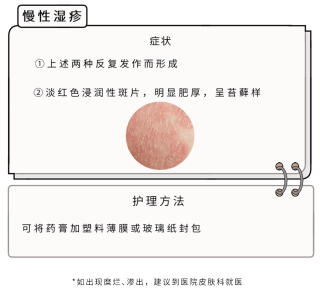 阿里巴巴:2024新澳精准资料免费大全-湿疹是长什么样的