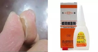 微博:新澳门一码一肖一特一中-强力胶怎么去除