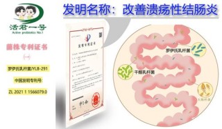 中新网:2024管家婆正版六肖料-溃疡性结肠炎吃什么药