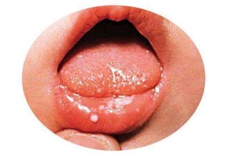 腾讯：澳门一肖一码100%精准-三次方程怎么解