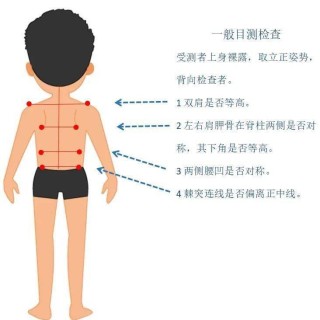 搜狗订阅:管家婆一肖-一码-一中一特-医生呼吁普及中小学生脊柱侧弯筛查