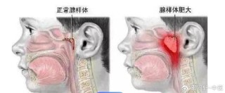 微博:新澳精选资料免费提供-吃什么促进腺样体萎缩