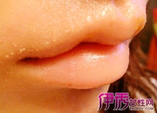 搜狐订阅：新澳门王中王资料公开-嘴唇起水泡是什么原因