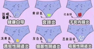 知乎：2024澳门免费精准资料-霉菌性阴炎什么症状
