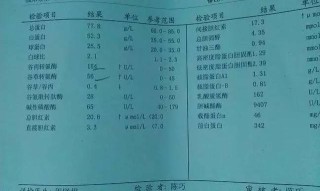 百度平台:香港好彩二四六免费资料大全澳门-谷丙转氨酶是什么