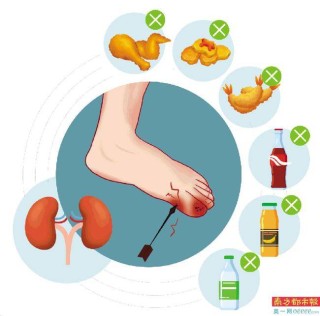 百家号:澳门正版资料大全有哪些-尿酸高是什么原因导致的
