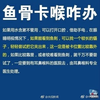 微博订阅:最准一肖一码一一子中特-鱼刺卡喉咙挂什么科