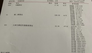 搜狐:新澳资料大全正版2024-表怎么看时间