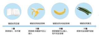 微博订阅:香港正版内部资料大公开-吃什么能让阴茎更硬