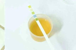 搜狐:管家婆一肖一码资料大全-尿液发黄是什么原因