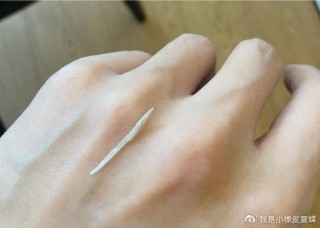 腾讯：澳门今晚必中一肖一码-张杰自曝鱼刺卡喉手术经历