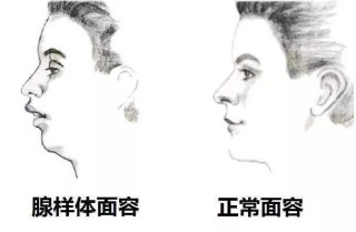 微博:新澳精选资料免费提供-吃什么促进腺样体萎缩