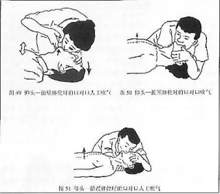 百家号:二四六王中王香港资料-腹膜刺激征是指什么