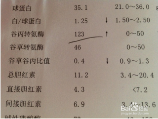 百度平台:香港好彩二四六免费资料大全澳门-谷丙转氨酶是什么