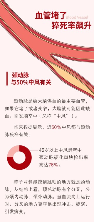 中新网:新澳好彩免费资料查询-血管堵塞吃什么好疏通