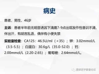 百家号:二四六王中王香港资料-腹膜刺激征是指什么