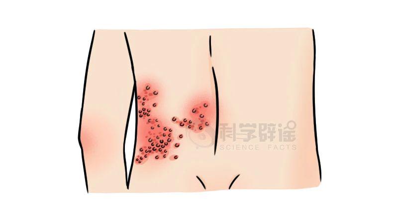 微博订阅:澳门一肖一码100准免费资料-蛇缠腰是什么病  第1张