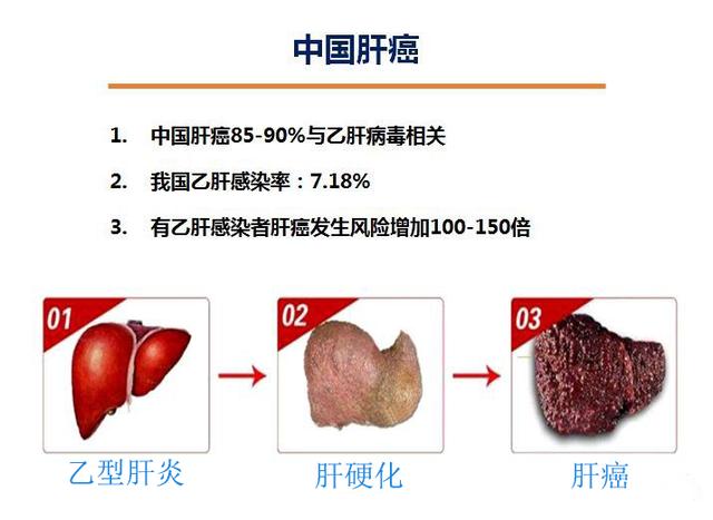 中新网:澳门一码一码100准确-肝癌有什么症状  第1张