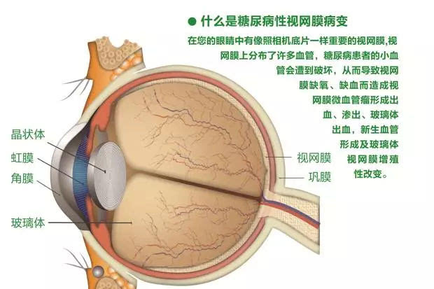 百度平台:新澳2024今晚开奖资料-瞳孔缩小见于什么病  第2张