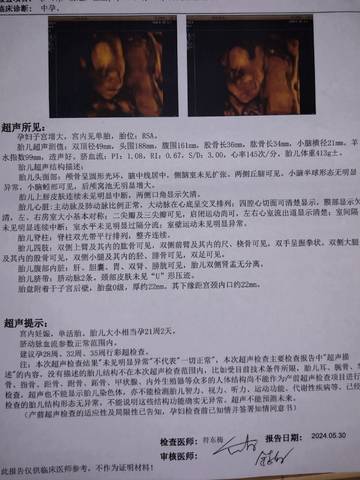 搜狐订阅：2024澳门一肖一码配套成龙-宫腔占位什么意思  第1张