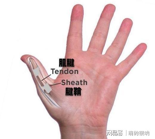 腾讯：正版澳门金牛版资料大全-大拇指腱鞘炎怎么治疗  第1张