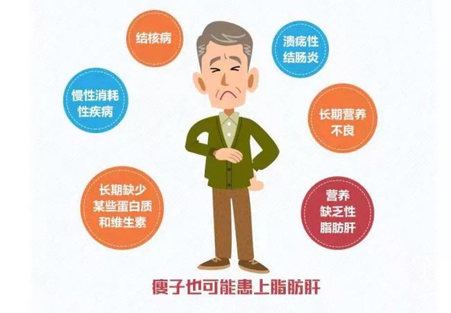 网易:2024今晚开特马开什么号-脂肪肝有什么危害  第3张