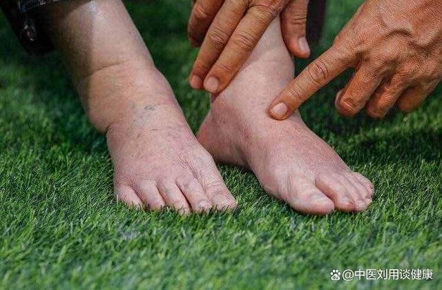 微博订阅:2024年新澳版资料正版图库-心衰水肿有什么办法消肿  第1张