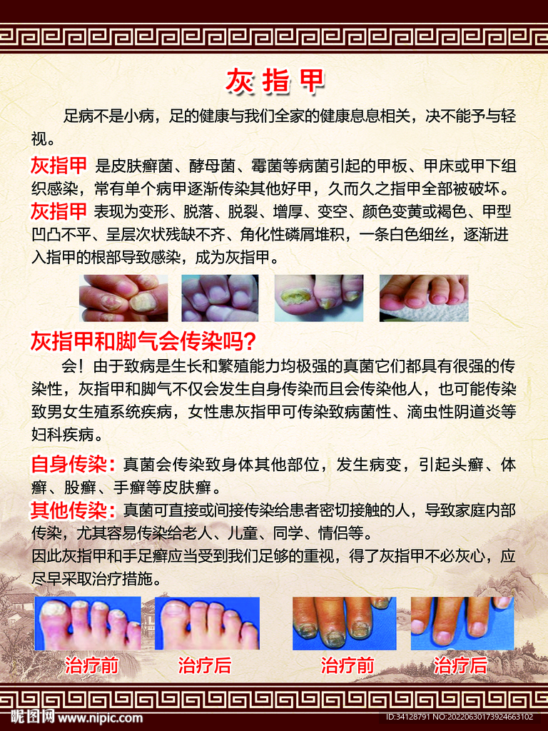 阿里巴巴:新澳门王中王资料-灰指甲有什么危害  第1张