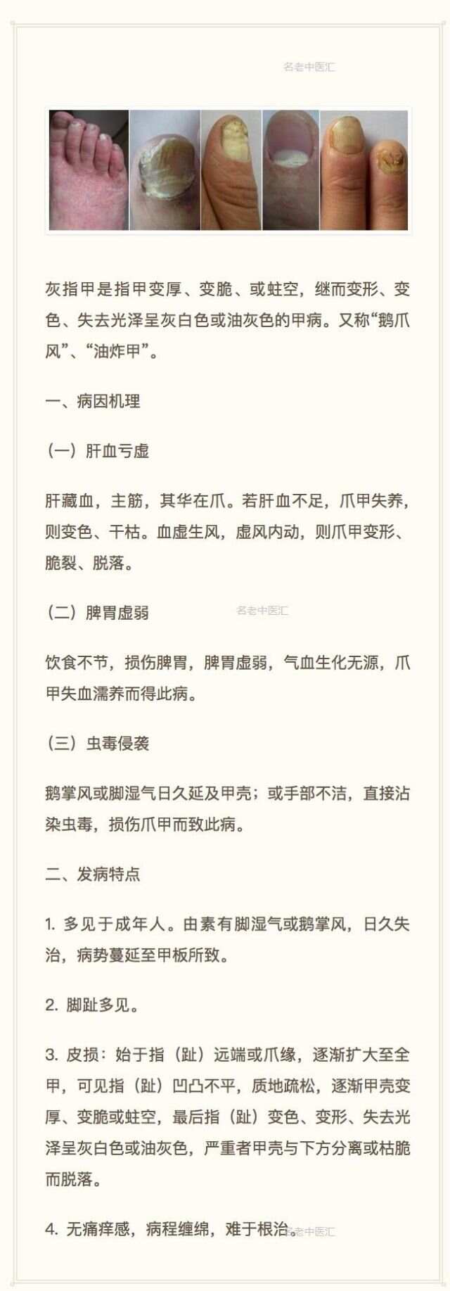 阿里巴巴:新澳门王中王资料-灰指甲有什么危害  第2张