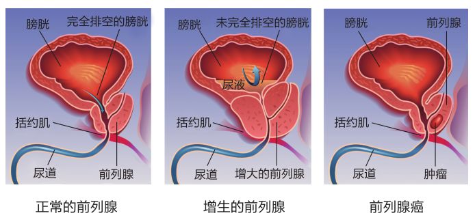 百家号:新奥门管家婆免费大全-前列腺增生伴钙化是什么意思  第2张