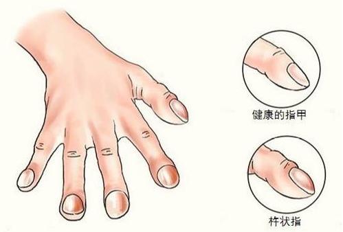搜狗订阅:香港一肖一码100%中-手指肿胀是什么原因  第1张