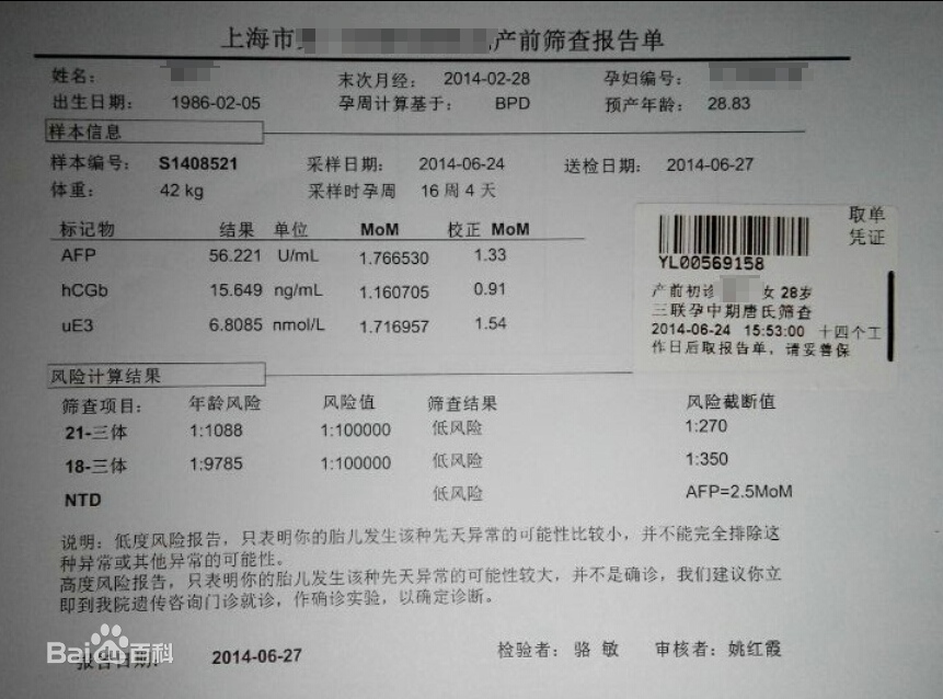搜狐:马会澳门正版资料查询-唐筛什么时候做  第3张