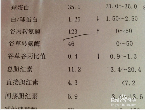 百度平台:香港好彩二四六免费资料大全澳门-谷丙转氨酶是什么  第2张