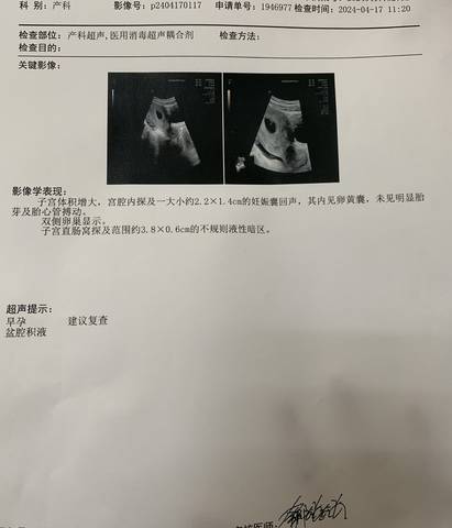 微博:2024新奥开奖结果-孕囊是什么  第1张