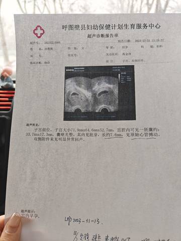 微博:2024新奥开奖结果-孕囊是什么  第3张