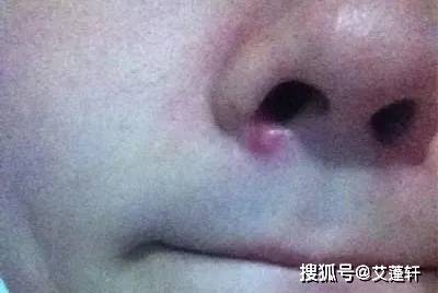 阿里巴巴:2024今晚开特马开什么号-鼻翼两侧长痘是什么原因  第3张