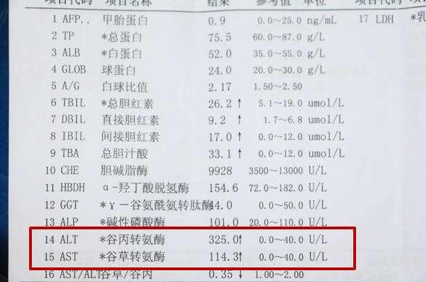 知乎：2024澳门天天开好彩大全开奖记录-转氨酶是什么意思  第2张