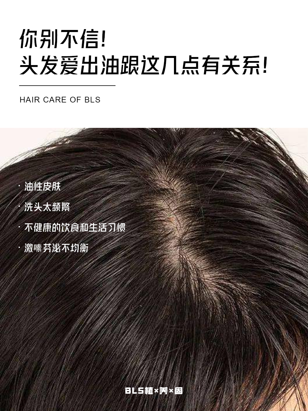搜狐:新澳门王中王资料-头发容易油是什么原因  第1张