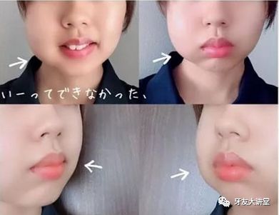 小红书:二四六王中王香港资料-半边脸肿是什么原因  第1张