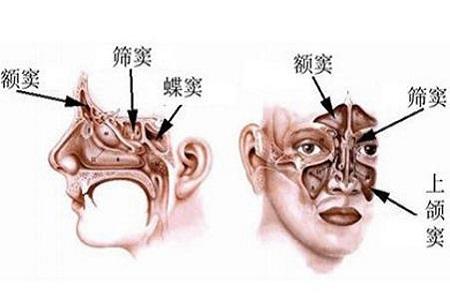 搜狗订阅:4949澳门开奖免费大全49图库-鼻窦炎有什么治疗方法  第1张