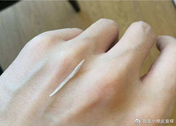 腾讯：澳门今晚必中一肖一码-张杰自曝鱼刺卡喉手术经历  第1张