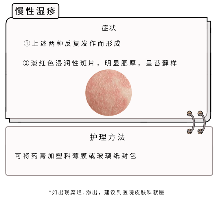 阿里巴巴:2024新澳精准资料免费大全-湿疹是长什么样的  第3张