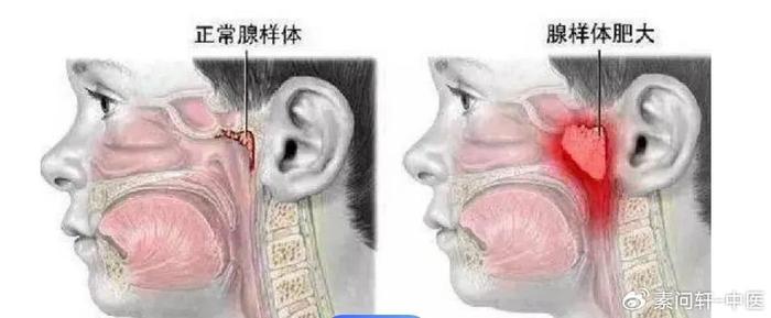 微博:新澳精选资料免费提供-吃什么促进腺样体萎缩  第1张