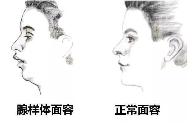 微博:新澳精选资料免费提供-吃什么促进腺样体萎缩  第2张