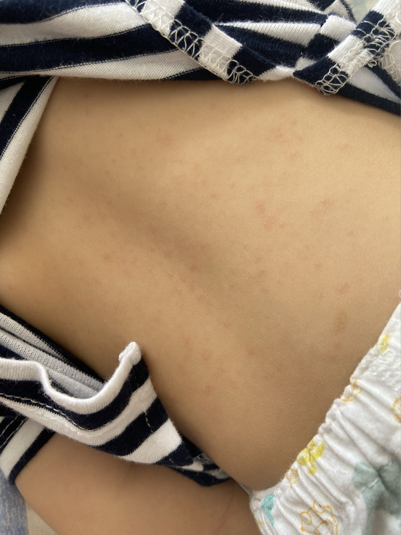 中新网:澳门今晚必中一肖一码-幼儿急疹是什么原因引起的  第1张